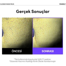 Pirinç Özü, Peptit ve Kolajen Içeren Gözenek Karşıtı Kağıt Maske