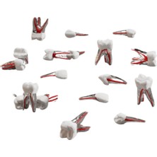 Endodontik Kanallı Diş 11 No Sağ Üst Santral (Beyaz Kron)