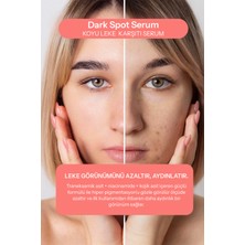 Koyu Leke Karşıtı Serum