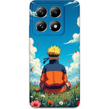 Xiaomi Mi 14 Uyumlu Anime Desenli Telefon Kılıfı + Ekran Koruyucu - 5747