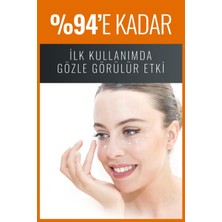 Perarise Göz Altı Torbası, Göz Çevresi Morluk ve Gözaltı Bakım Kremi 30 ml