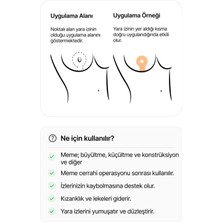 Luofucon Silikon Skar Mastopeksi Areola Meme Küçültme Dikleştirme Ameliyat Izi Tedavisi Areopksi 2'li