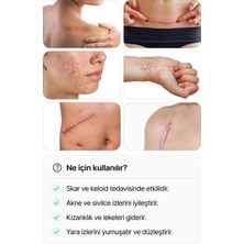 Luofucon Skar Giderici Silikon Şerit Keloid Sezaryen Cilt Çatlakları Bbl Ameliyat Izi  1'li