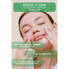 Alvori Dermokozmetik Sebo Mask,dengeleyici ve Gözenek  Maske 250 ml