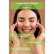 Alvori Çay Ağacı Maskesi, Tea Tree Bubble Mask, Akne ve Leke Görünümünü , Yeni Akne Oluşumunu Engeller, Cildi Fazla Yağdan Arındırır. (250 Ml)