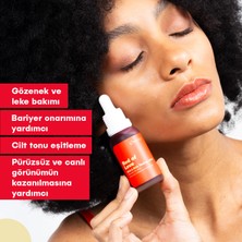S'he Vec RED OF LOVE - AHA %10 & BHA %2 Cilt Tonu Eşitleyici Canlandırıcı Kırmızı Peeling Serum 30ml