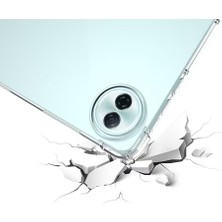XFashion Honor Pad 10 Dört Köşe Darbeye Dayanıklı Şeffaf Tablet Tpu Kılıfı (Yurt Dışından)