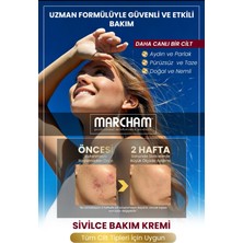 Marcham Bakım Kremi- Akne ve Siyah Nokta