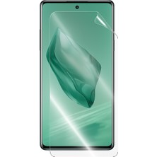 Oneplus Nord 3 Ekran Koruyucu Hidrojel Nano Esnek Şeffaf