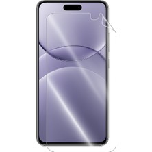 Huawei Nova 13 Ekran Koruyucu Nano 9h 0.3mm Esnek