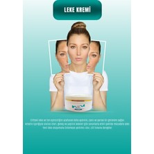 Leke Kremi (Anti-Spot Cream)