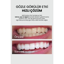 Aktif Karbon Diş Beyazlatma Macunu