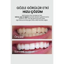 Luis Bien Aktif Karbon Diş Temizleme Tozu