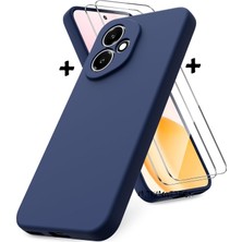 Honor 400 Kılıf Kamera Korumalı Yumuşak Renkli Mat Kadife Silikon + 9h Ekran Koruyucu Cam 2in1 Set