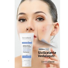 Dermaderm Bitkisel Siyah Nokta Karşıtı Gözenek Temizleyici Yüz Bakım Kremi 100 Ml.