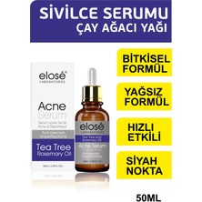 Rosemary Oil Çay Ağacı Yağı Akne ve Siyah Nokta Cilt Bakım Serumu 50ML.