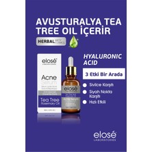 Rosemary Oil Çay Ağacı Yağı Akne ve Siyah Nokta Cilt Bakım Serumu 50ML.