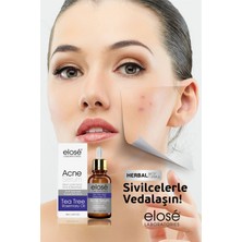 Rosemary Oil Çay Ağacı Yağı Akne ve Siyah Nokta Cilt Bakım Serumu 50ML.