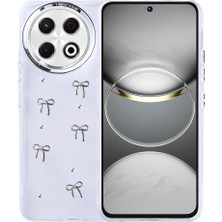 Tecno Spark 30 Pro Kılıf Airbag Tasarımlı Simli Şeffaf Mnc Kutup Kapak - Fiyonk