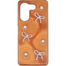 Nettech Tecno Camon 20 Pro Uyumlu Manu Seri Arka Koruma Kılıf