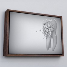 Çerçeveli Diş Kliniği Duvar Tablosu, Çürüyen Diş, Diş Hekimi TABLO-5372