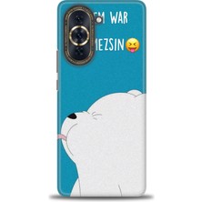 Huawei Nova 10 Pro Kılıf Hd Baskılı Kılıf + Nano Tam Kaplayan Ekran Koruyucu 152