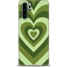 Huawei P30 Pro Kılıf Hd Baskılı Kılıf + Nano Tam Kaplayan Ekran Koruyucu 200