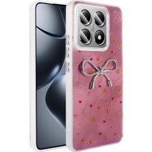 Zore 14T Pro Kılıf Kamera Korumalı Figürlü Senk Ponti Silikon Kapak - Açık Pembe