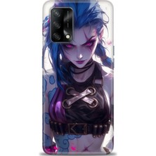 Oppo A74 Kılıf Hd Baskılı Kılıf + Seramik Tam Kaplayan Ekran Koruyucu 276