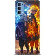 Rulet Oppo Reno 4 Kılıf Hd Baskılı Kılıf + Seramik Tam Kaplayan Ekran Koruyucu 260