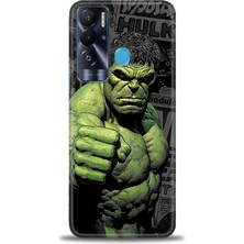 Tecno Pova Neo Kılıf Hd Baskılı Kılıf + Seramik Tam Kaplayan Ekran Koruyucu 97