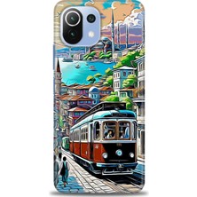 Rulet Xiaomi Mi 11 Lite Kılıf Hd Baskılı Kılıf + Seramik Tam Kaplayan Ekran Koruyucu 225