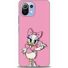 Xiaomi Mi 11 Lite Kılıf Hd Baskılı Kılıf + Seramik Tam Kaplayan Ekran Koruyucu 406