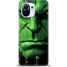 Xiaomi Mi 11 Kılıf Hd Baskılı Kılıf + Seramik Tam Kaplayan Ekran Koruyucu 94