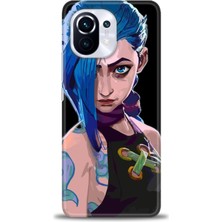 Xiaomi Mi 11 Kılıf Hd Baskılı Kılıf + Seramik Tam Kaplayan Ekran Koruyucu 271