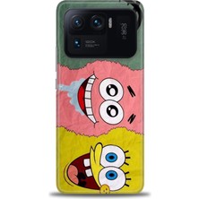 Xiaomi Mi 11 Ultra Kılıf Hd Baskılı Kılıf + Seramik Tam Kaplayan Ekran Koruyucu 460