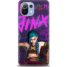 Rulet Xiaomi Mi 11 Lite Kılıf Hd Baskılı Kılıf + Seramik Tam Kaplayan Ekran Koruyucu 275