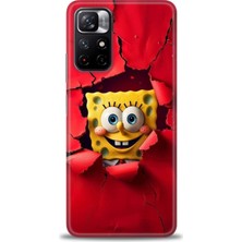 Xiaomi Redmi Note 11S Hd Baskılı Kılıf + Seramik Tam Kaplayan Ekran Koruyucu 458