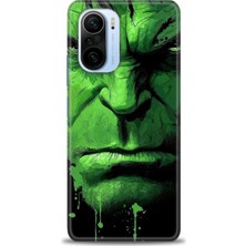 Xiaomi Redmi K40 Hd Baskılı Kılıf + Seramik Tam Kaplayan Ekran Koruyucu 94