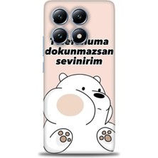 Xiaomi Mi 14T Pro Kılıf Hd Baskılı Kılıf + Seramik Tam Kaplayan Ekran Koruyucu 158