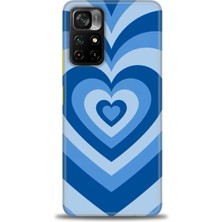 Rulet Xiaomi Poco M4 Pro 5g Kılıf Hd Baskılı Kılıf + Seramik Tam Kaplayan Ekran Koruyucu 194