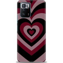 Xiaomi Poco X3 Gt Kılıf Hd Baskılı Kılıf + Seramik Tam Kaplayan Ekran Koruyucu 191