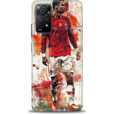 Xiaomi Redmi Note 11 Pro 4g Hd Baskılı Kılıf + Seramik Tam Kaplayan Ekran Koruyucu 2