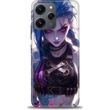 Xiaomi Redmi 12 Kılıf Hd Baskılı Kılıf + Seramik Tam Kaplayan Ekran Koruyucu 276