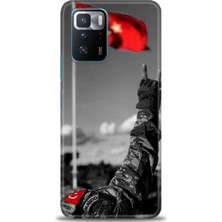 Xiaomi Poco X3 Gt Kılıf Hd Baskılı Kılıf + Seramik Tam Kaplayan Ekran Koruyucu 35