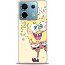 Xiaomi Redmi Note 13 Pro 5g Hd Baskılı Kılıf + Seramik Tam Kaplayan Ekran Koruyucu 457