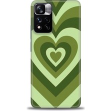 Rulet Xiaomi Redmi Note 11 Pro Plus Hd Baskılı Kılıf + Seramik Tam Kaplayan Ekran Koruyucu 200