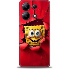 Xiaomi Redmi Note 13 4g Hd Baskılı Kılıf + Seramik Tam Kaplayan Ekran Koruyucu 458