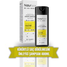 Naturface Kükürt Şampuanı Kepekli Saçlar Için 400 ml