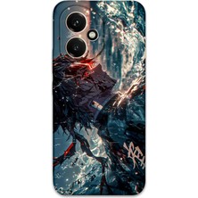 Gramaphone Honor 400 Uyumlu Anime Desenli Telefon Kılıfı + Ekran Koruyucu - 5749